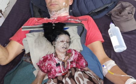 पंद्रपाली में स्टोव की चिंगारी बनी हादसे का कारण, पति-पत्नी झुलसे