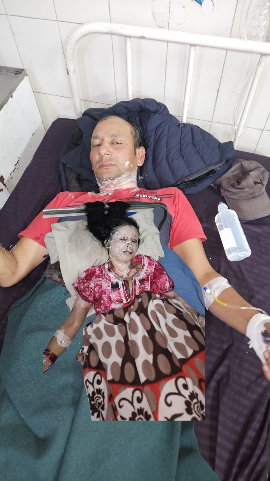 पंद्रपाली में स्टोव की चिंगारी बनी हादसे का कारण, पति-पत्नी झुलसे