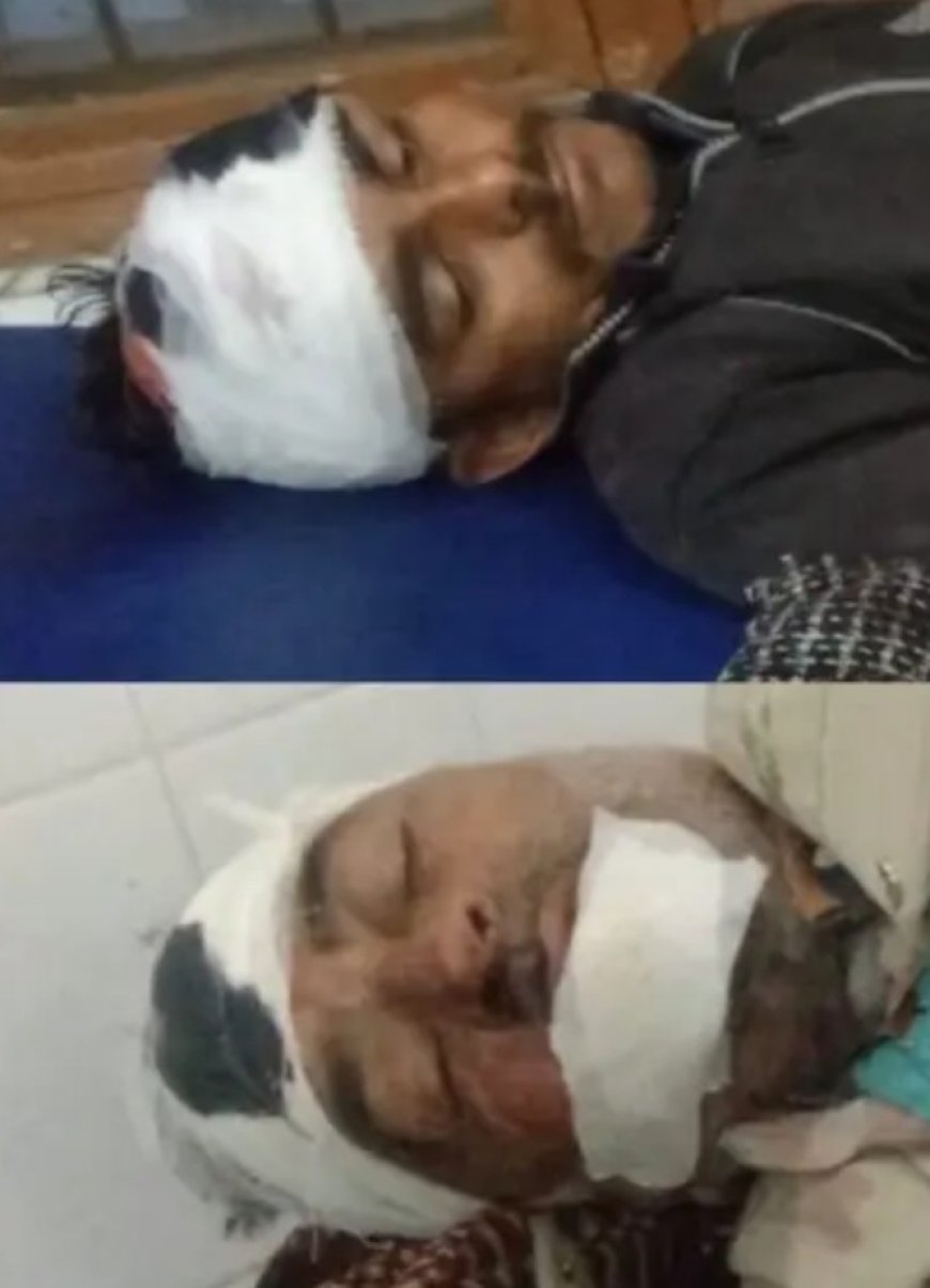 हरिद्वार। चंडीघाट बदमाशों का घाट बन गया है। चंडी घाट चौराहे पर रोजाना सरे आम लड़ाई झगड़े व मारपीट की सूचनाऐ प्रसारित होती रहती हैं